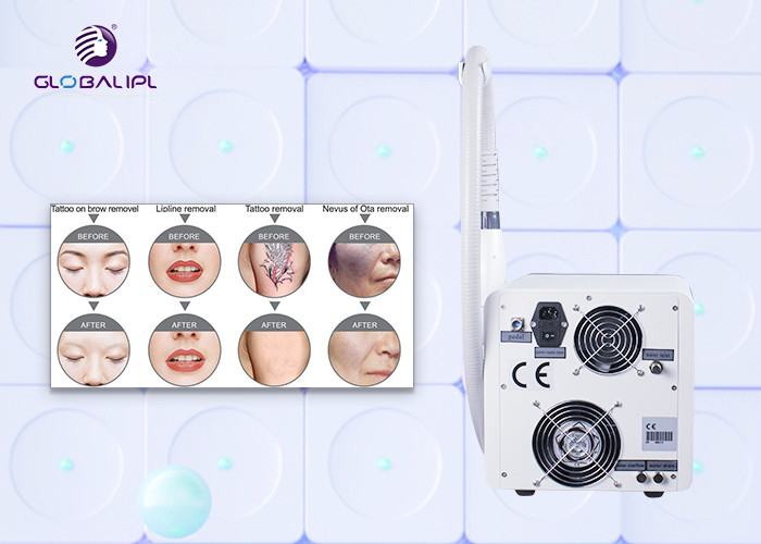 ND YAG Laser Tattoo Removal Equipment 8.4 Inch Color Touch Screen Display