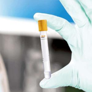 Quality Free Sample Sterile Vacuum Blood Collection Tube wholesale