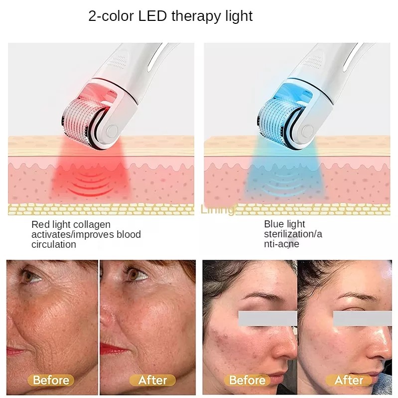 3 IN 1 LED Microneedle Roller Kit LED 0.5 mm Dr. pen Derma Roller Derma Rolling System