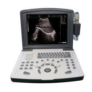 Quality Portable Full Digital Diagnostic Ultrasound scanner OEM wholesale