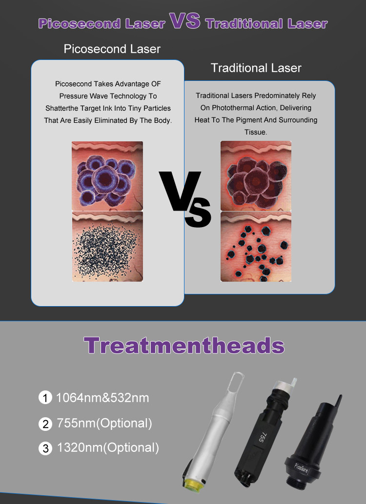 P1 Vertical Picosecond Laser Q Switched Pigmentation Removal Pico Laser Tattoo Removal Machine