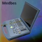 Hospital Equipment Digital Ultrasound System with Workstation