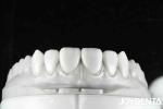 Revolutionize Your Dental Practice with Natural Tooth Morphology Tooth