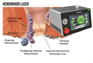 Quality Dual Wavelength Medical Diode Laser wholesale