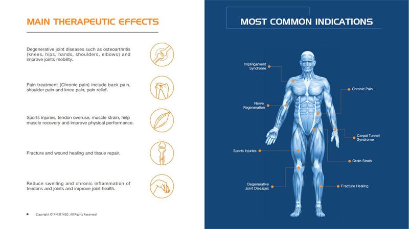 130KHz Magnetic Therapy Device For Treating Musculoskeletal Disorders Physio Magneto Infrared Physiotherapy