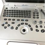 Chinese Full Digital Laptop 4D 5D Human Color Ultrasound Scanner portable Laptop