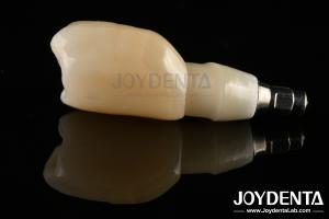 Quality Shoulder Margin Design Dental Implant Bars For Wide Prosthetic Platform Needs wholesale