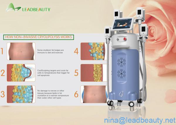 Great weight loss 0kpa-100kpa Vacuum machine cryolipolysis