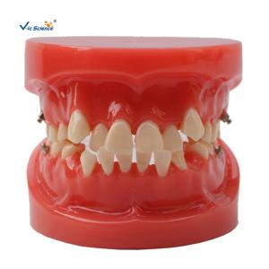 Quality Orthodontic Dental Study Models Tooth Teaching , Dental Models For Patient Education wholesale