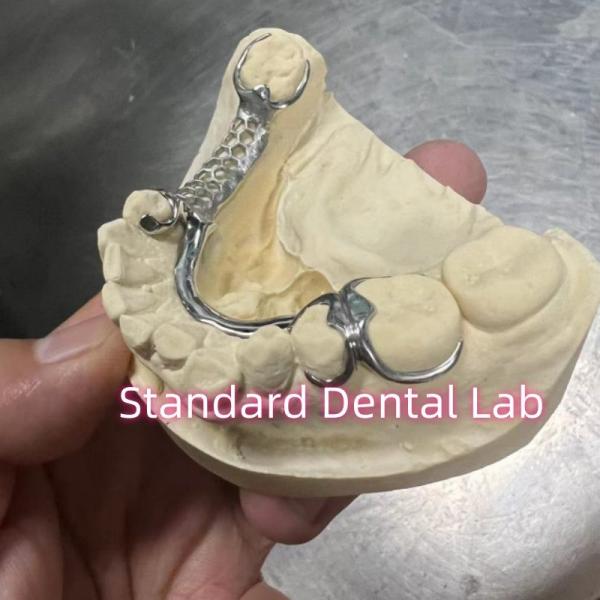 Cheap Skelete Chrome Cast Partial Denture Metal Framework ISO for sale