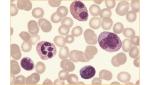 Liu's Haematocyte Stain Kit For Classification Of Hematocytes