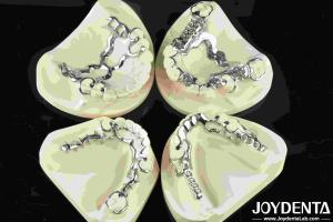 Quality Good Fit Dental Metal Framework Metallic Material For Durable Dental Restorations wholesale