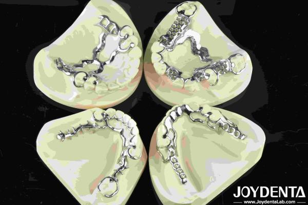 Good Fit Dental Metal Framework Metallic Material For Durable Dental Restoration