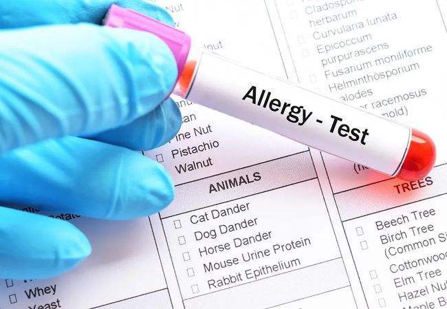 Allergen Testing Immunoglobulin E（IgE） test kit for Clinical In Vitro Diagnostic closed system analyzer