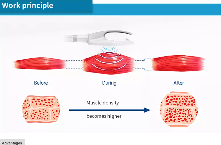 Medical Portable RF Radio Frequency Machine For Face Lift / Skin Rejuvenation
