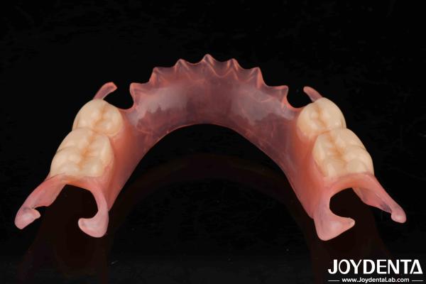 Comfortable Fit Dental Flexible Denture Finish With High Stealth Diverse