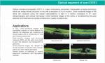 Spectral Domain OCT Optical Coherence Tomography for ophthalmology department