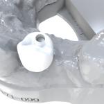 Zhongchuang Medicals Resin Permanent Crown Materials The Perfect Blend Of