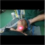 Red Light Rigid Stylet Steel Video Nasopharyngoscope with Handle Usableness