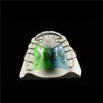 Mouth Orthodontic Expanders Adults Plate For Dental Alignment