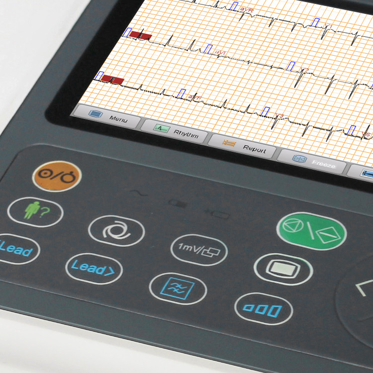 Medical Pocket Portable ECG Machine 12 Lead 3 Channel