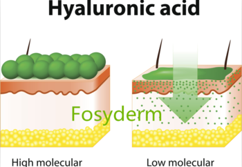 Fosyderm Hyaluronic Acid Forehead Wrinkles 1ml 2ml Injectable Filler Type