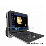 Hospital 4D Fetal doppler Ultrasound Scanner