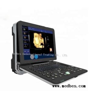 Quality Hot Color Doppler Ultrasound Diagnosis System wholesale