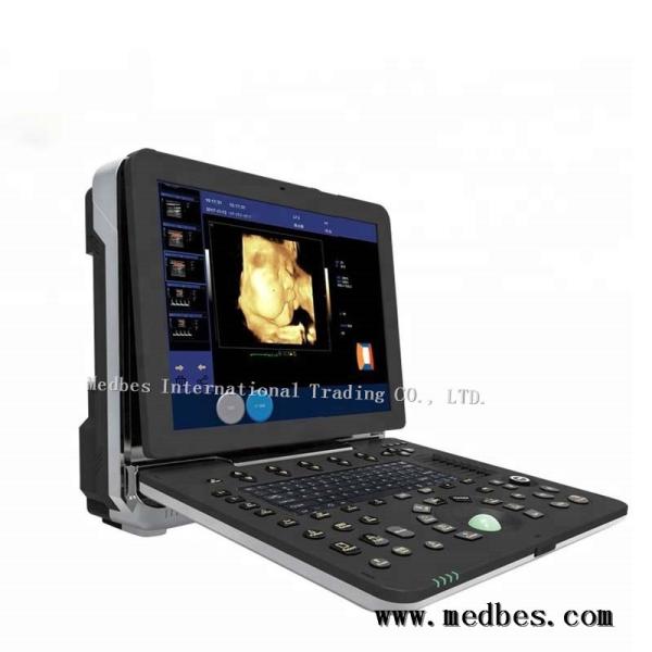4D Realtime Musculoskeletal Ultrasound Systems fetal doppler ultrasound