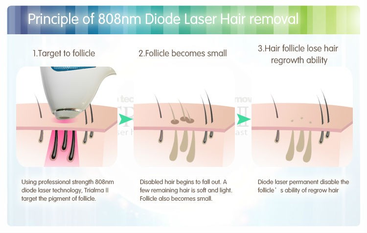 Safety No Pain Mobile Diode Laser Hair Removal Machine For Beauty Salons