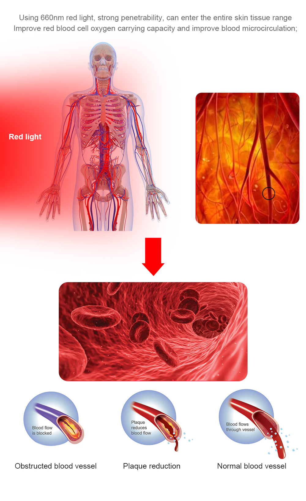 PDT Treatment Red Light Therapy Canopy Infrared Pain Relief Device