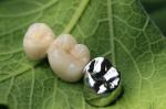 Metal Framework PFM Dental Crown