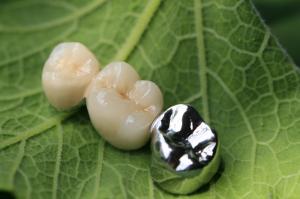 Quality Metal Framework PFM Dental Crown wholesale