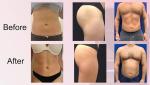 Desktop EMS Slimming Machine Professional Cellulite Machine For Skin Care