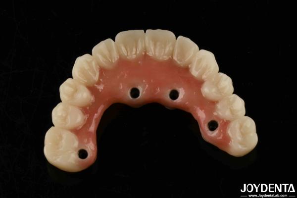 Quick Drying Titanium Bar Acrylic Teeth Finishing Clear Acrylic Teeth Dental