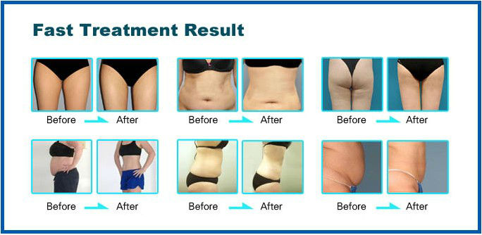 7 In 1 Professional Cavitation RF Vacuum Slimming Machine For Fat Loss