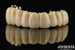 Custom Made Ti-Bar Zirconia Hybrid Bridge Precision Fit Dental Prosthesis