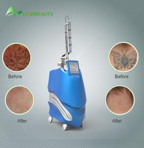 Quality 1064/532nm standard 755/585/650nm for option the Nd:YAG laser tattoo removal machine wholesale