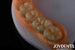 High Aesthetics Full Contour Zirconia For Crowns Bridges Implants Dental