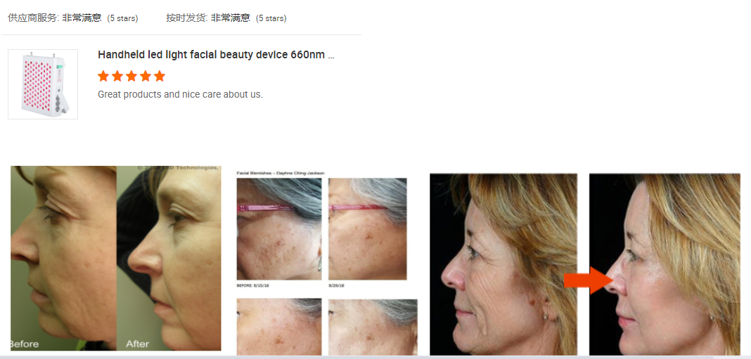 100V 1500W LED Light Therapy Panel Removal Wrinkle Acne