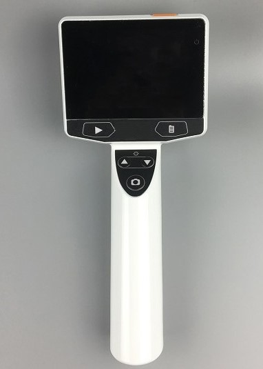 5V 2000mA Ear Nose And Throat Equipment 3 inch TFT LCD Screen Portable Digital Otoscope Set