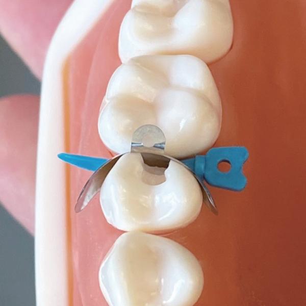 Dentistry Dental Sectional Matrix System Dental Matrices And Wedges Plastic