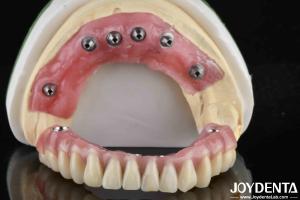 Quality Translucent Ti-Base Acrylic Teeth Finish for Dental Laboratory Production wholesale