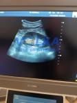 Trolley Color Doppler Vascular Ultrasound SonoScape S40