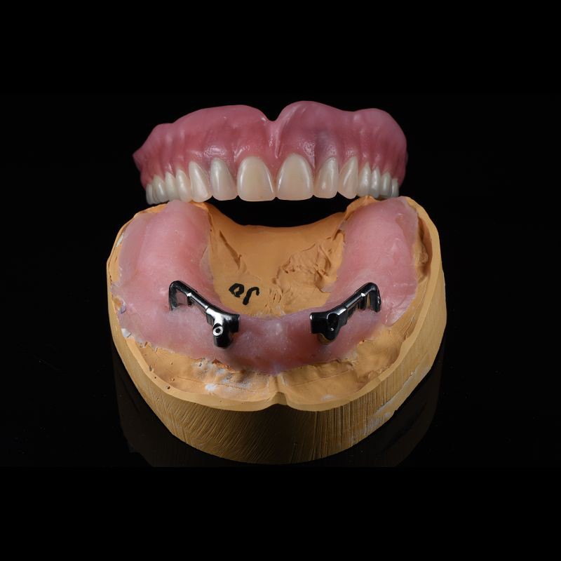 CAM Milled Titanium Bar Dental Implant Hybrid Prosthesis Dentures