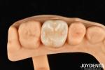 High Wear Resistance Dental Full Zirconia High Strength Full Contour Zirconia