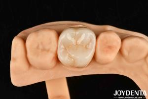 Quality High Wear Resistance Dental Full Zirconia High Strength Full Contour Zirconia Bridge wholesale