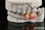 Stable Oral Structure For Dental Professionals In Firmly Connect The Row Teeth