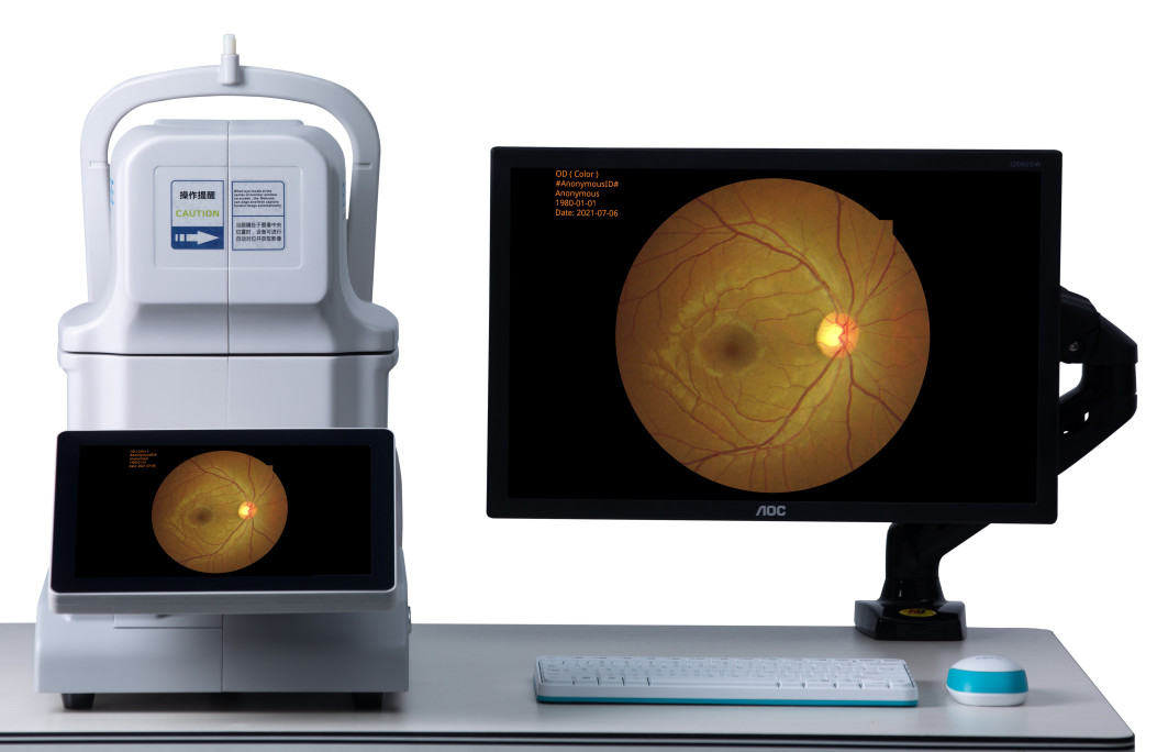 Portable Non Mydriatic Retinal Camera With 2.8mm Pupil DICOM & AI Manual Focus