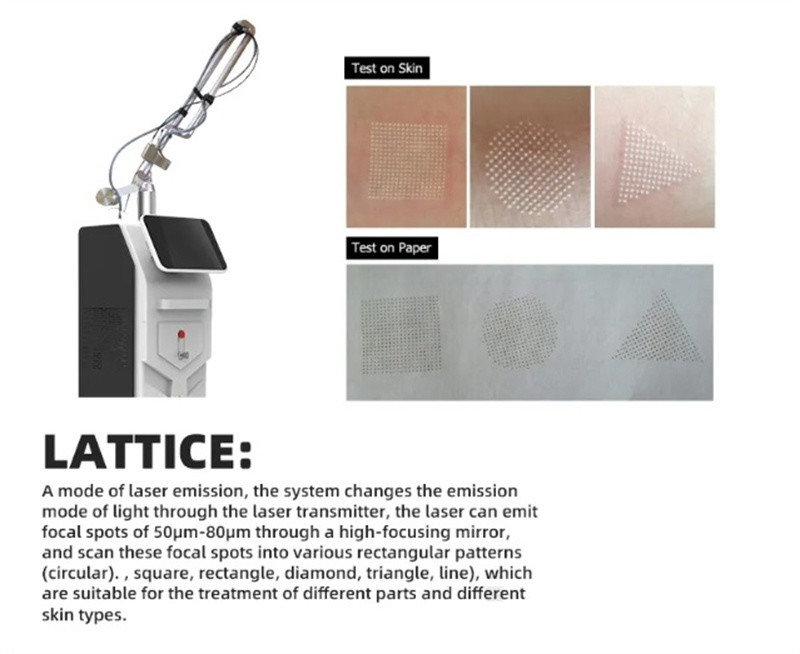 Vertical Fractional Co2 Laser Machine Pigment Removal Scar Removal